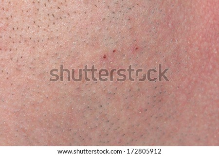 close up view of a human skin (series)
