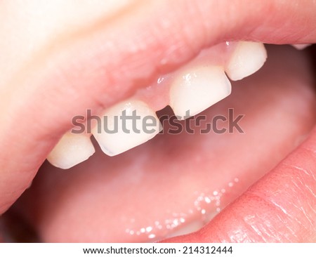 teeth in the mouth. close-up