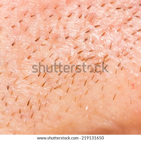 the bristles on the skin. close-up