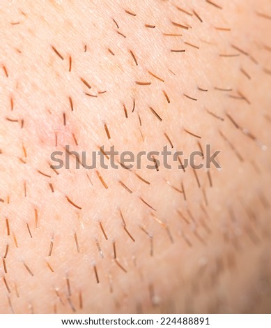 bristles on the skin. close-up