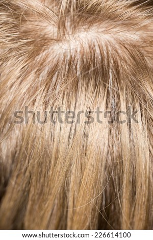 pattern of hair