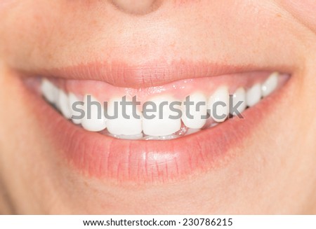 beautiful smile with white teeth
