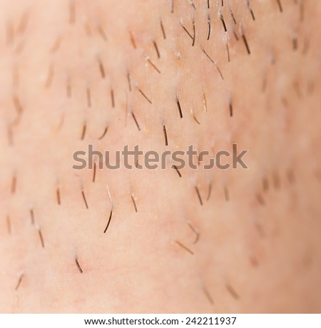 bristles on the skin. close-up