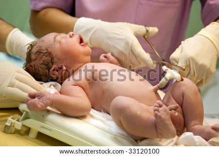 New born baby being treated just after the birth