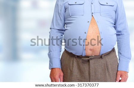 Obese man abdomen. Obesity and weight loss.