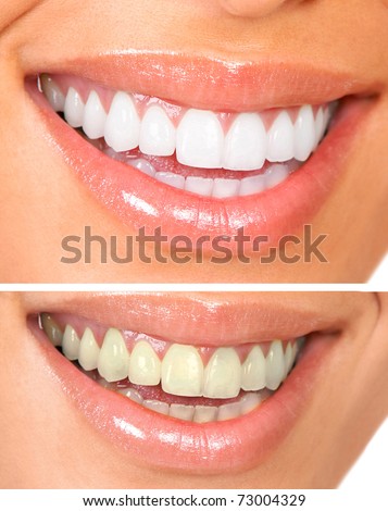 Whitening. Dental care. healthy woman white teeth.