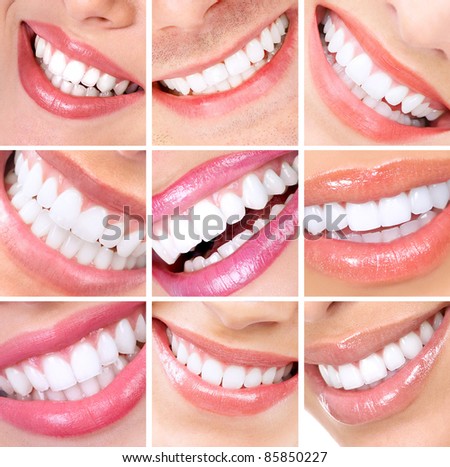 Smiling woman mouth with healthy teeth. Collage.