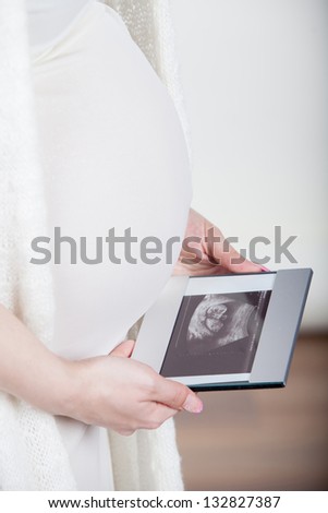 young pregnant woman looking at ultrasound image