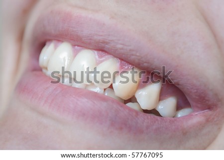 Woman teeth with smile