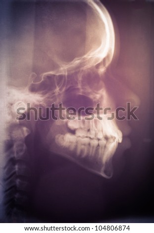 Human skull scan closeup