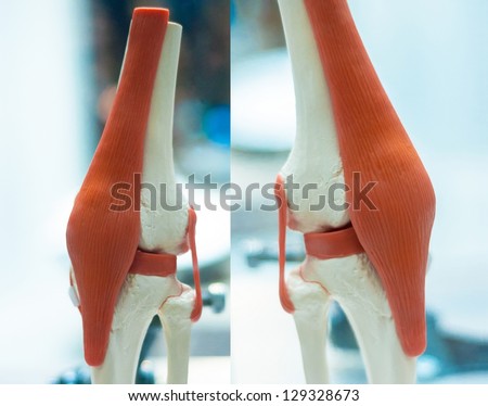 Medical photo of artificial muscles and bones