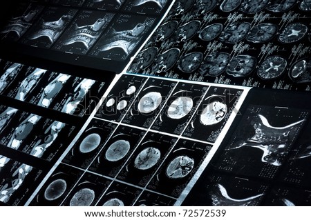 Several CT computer tomography scan images of neck and brain