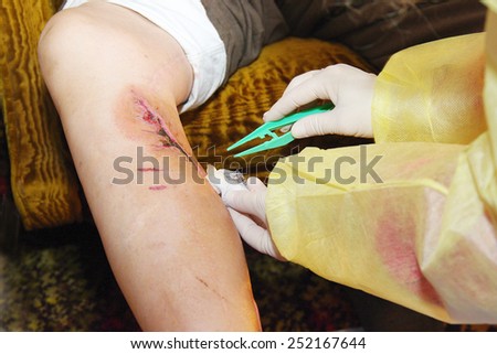 Wound care by a nurse at home