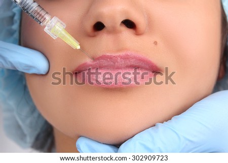 Beautiful girl on rejuvenation procedure in beauty clinic filler injection. Injections lips close up.