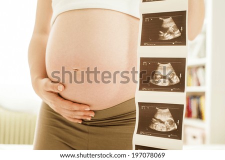 Unrecognizable pregnant woman holding ultrasound scan picture