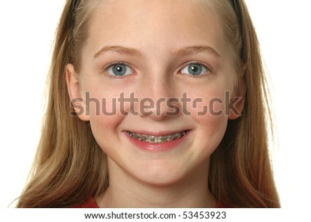 teeth braces colors. girl with dental braces on
