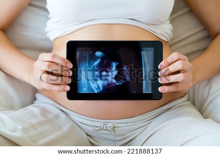 Portrait of pregnant woman holding ultrasound scan on her belly.