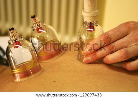 Massage vacuum flask, Chinese Flask Massage