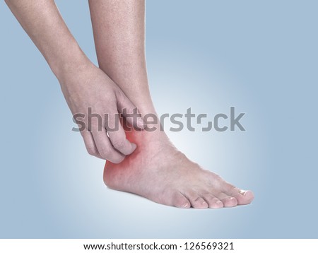 Women scratch itchy ankle with hand. Healthcare And Medicine Concept photo with colour enhanced skin to emphasize problematic part.