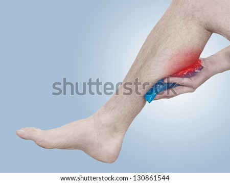 Acute pain in a man calf