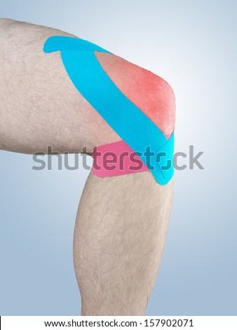 Physiotherapy treatment with therapeutic tape for knee pain, aches and tension. It  is also used for prevention and treatment in competitive sports.