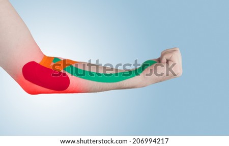 Physiotherapy treatment with therapeutic tape for elbow pain, aches and tension. It is also used for prevention and treatment in competitive sports.