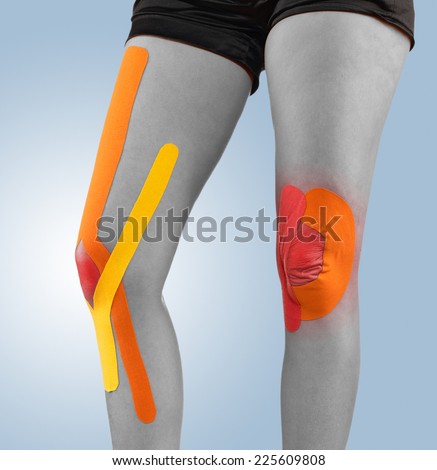 Injured knee treated with tape therapy.