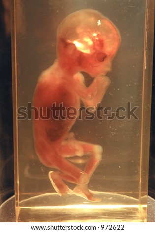 Month Old Fetus