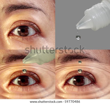 Procedure of applying eye care drops.