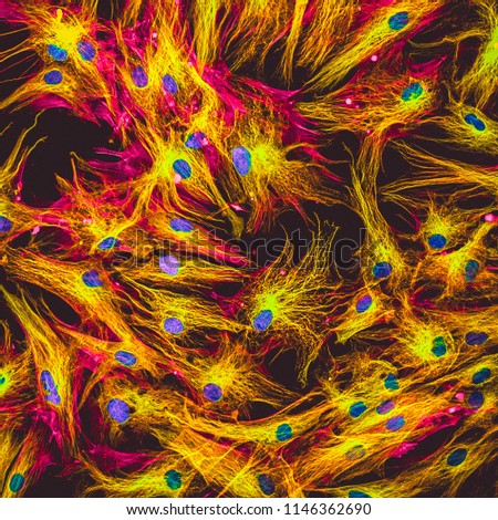 Real fluorescence microscopic view of human skin cells in culture. Nucleus are in blue, actin filaments are in pink, tubulin was labeled with green