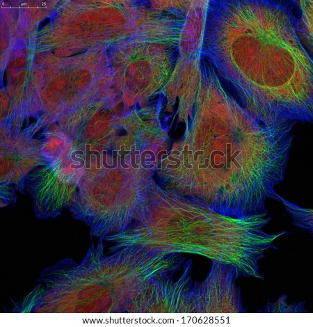 Fibroblasts (skin  cells) labeled with fluorescence dyes. This image was taken with a digital camera on a confocal microscope.