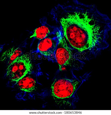Epithelial tumor cells labeled with fluorescent dyes. Nucleus are in red, cytoskeleton filaments are in green, membrane labeled with blue