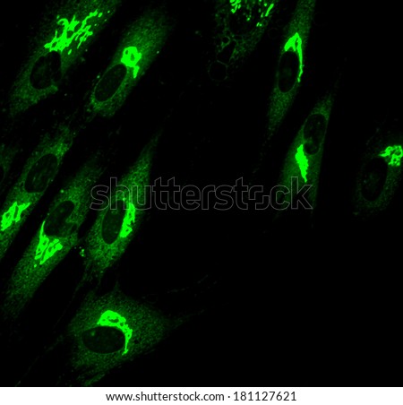 Fibroblasts (skin  cells) labeled with fluorescent dyes