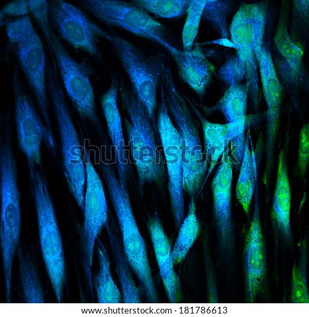 Fibroblasts skin cells labeled with fluorescent dyes Fibroblasts skin cells labeled with fluorescent dyes