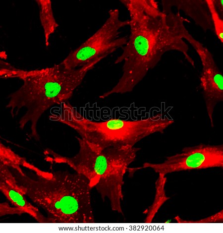 Mesenchymal stem cells labeled with fluorescent molecules