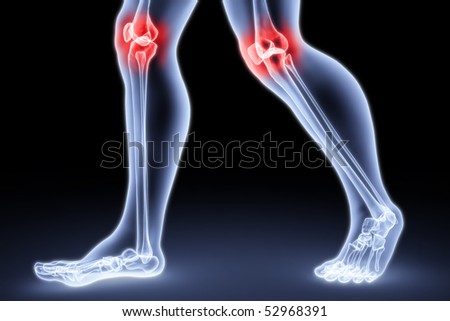 stock photo male feet under the Xrays knee joints are highlighted in