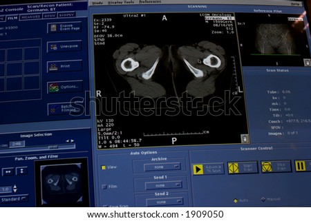 A computer monitoring a scan of human body