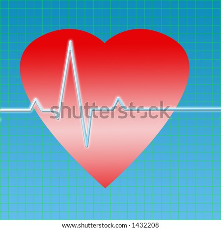 Heart Diagram Test. Ecg+heart+diagram , myocardial infarction Examine the of d max frases de