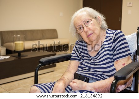 Elderly eighty plus year old handicap woman in a medical office setting.