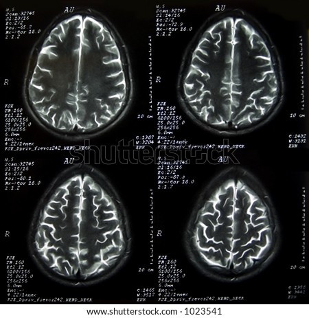 Parts of Brain scans