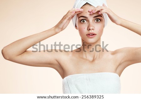Girl squeezing her pimples, removing pimple from her face.  Woman skin care concept / photos of ugly problem skin brunette girl on beige background