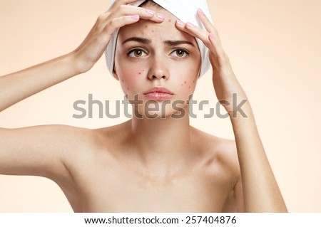 Young woman squeezing her pimple, removing pimple from her face.  Woman skin care concept