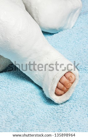 Baby boy's leg with plaster bandage