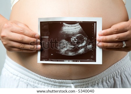 A shot of a pregnant woman carrying her child\'s ultrasound picture