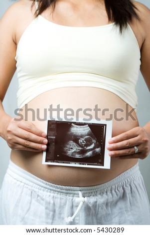 A shot of a pregnant woman holding her ultrasound scan of her unborn child