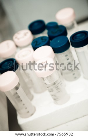 A shot of DNA samples in a research laboratory