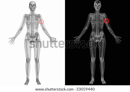 humerus bone anatomy. stock photo : Human Anatomy