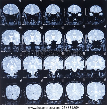 CT computer tomography scan image