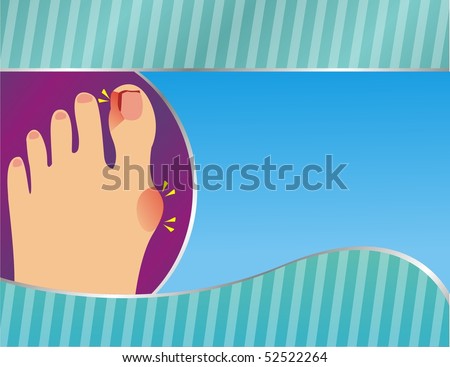 Foot with Bunion Ad Layout