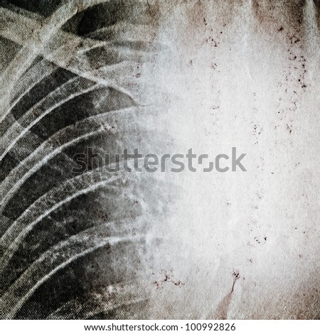 x-ray of human chest old grunge paper texture background